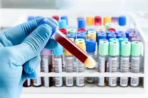 年龄越大越要吃肉 清华研究 多吃肉的老人或更长寿 吃什么肉好