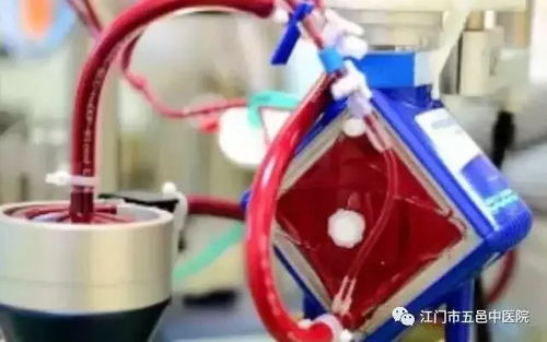 江门市首例跨院体外膜肺转运成功,创造医学奇迹